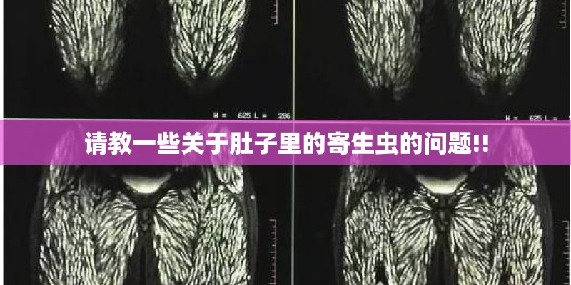 请教一些关于肚子里的寄生虫的问题!!