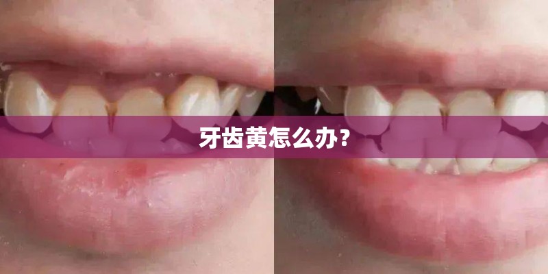 青海雪莲的栽培要点 青海雪莲的栽培要点