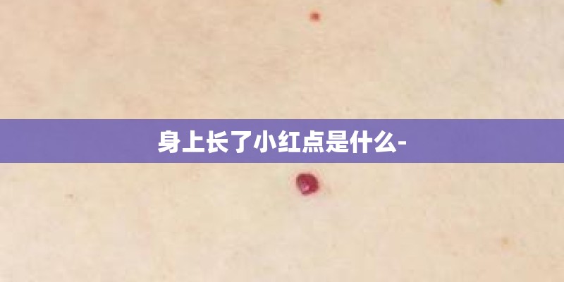 身上长了小红点是什么-