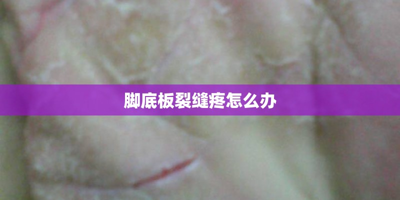 脚底板裂缝疼怎么办