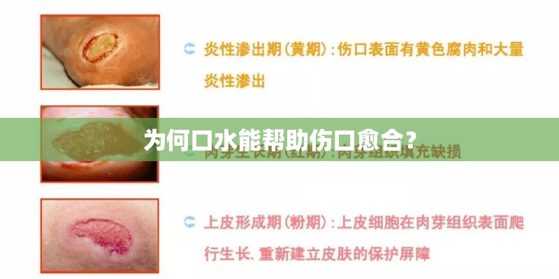为何口水能帮助伤口愈合? 为何口水能帮助伤口愈合?