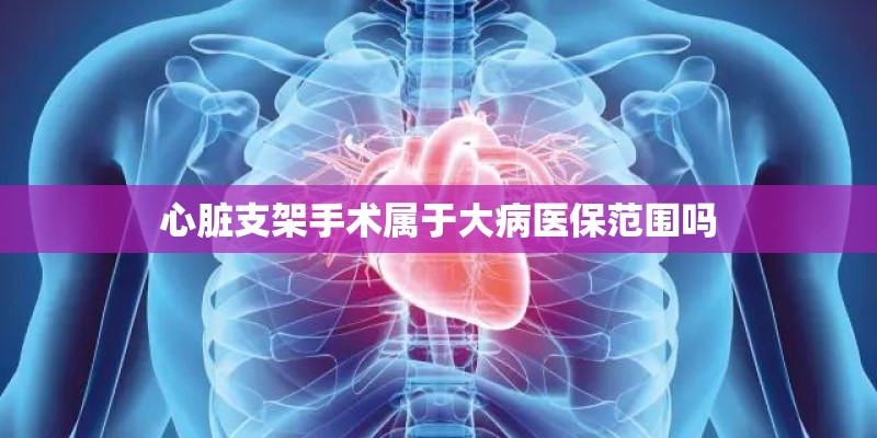 心脏支架手术属于大病医保范围吗