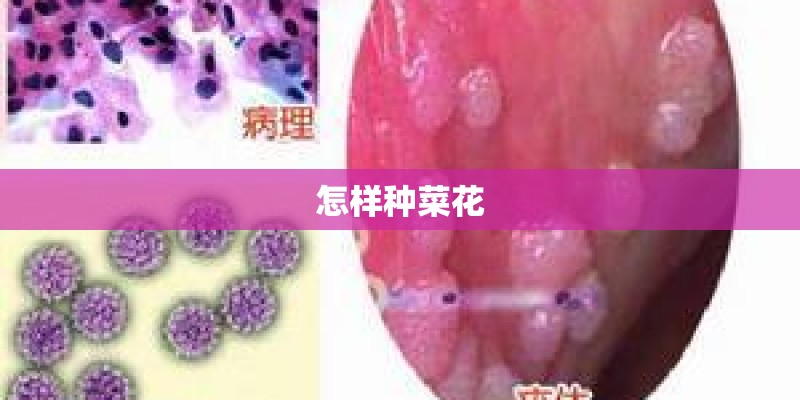怎样种菜花