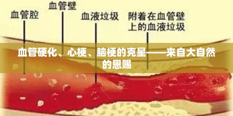 血管硬化、心梗、脑梗的克星——来自大自然的恩赐