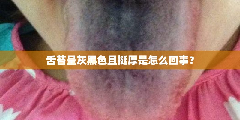 舌苔呈灰黑色且挺厚是怎么回事？